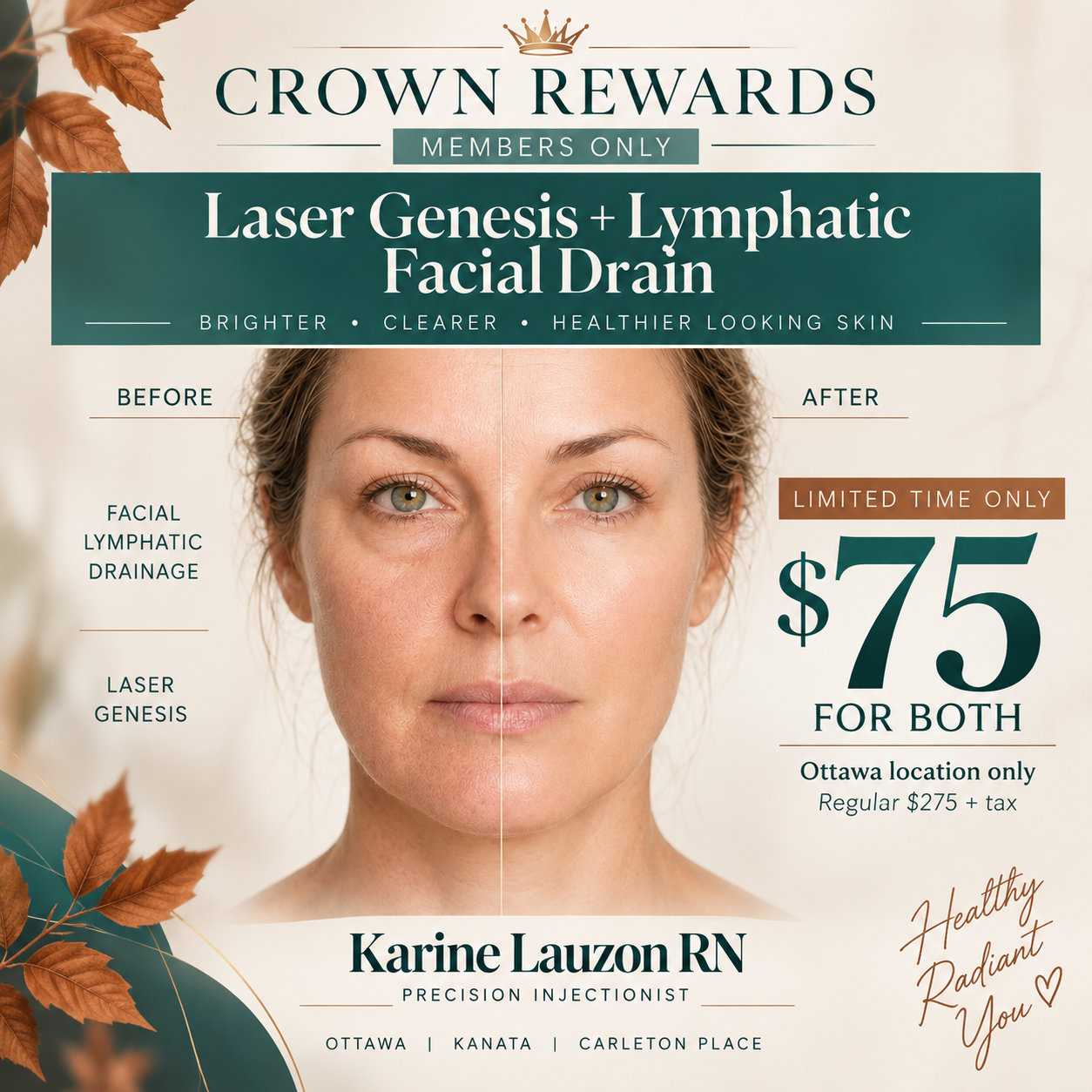 Crown Rewards Members Only — Laser Genesis + Lymphatic Facial Drain — $75 For Both