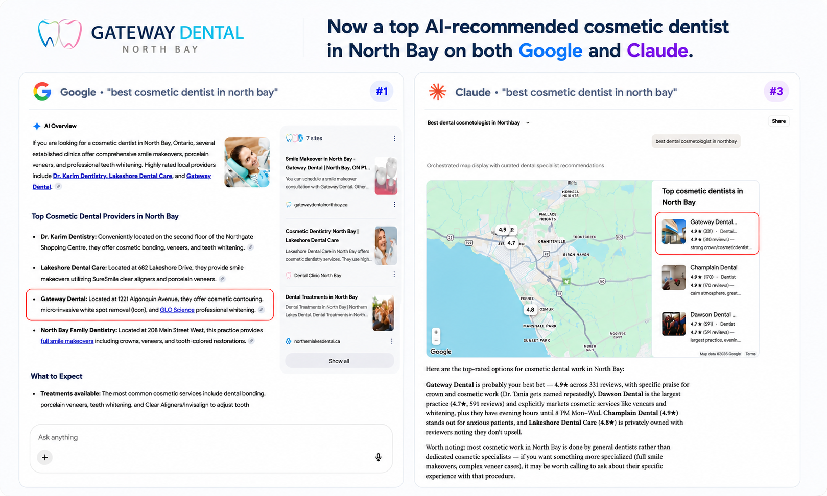 Gateway Dental recommended for cosmetic dentistry in North Bay on Google and Claude